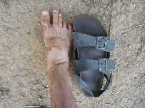 Keith's foot after a hard day's work. 